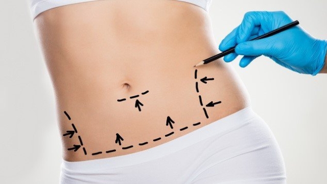 Flat and Fabulous: Unveiling the Benefits of Abdominoplasty