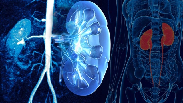 Pee-rfectly Informed: Exploring the World of Urology