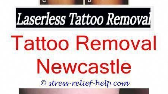 What Will Not Know About Tattoo Laser Removal!